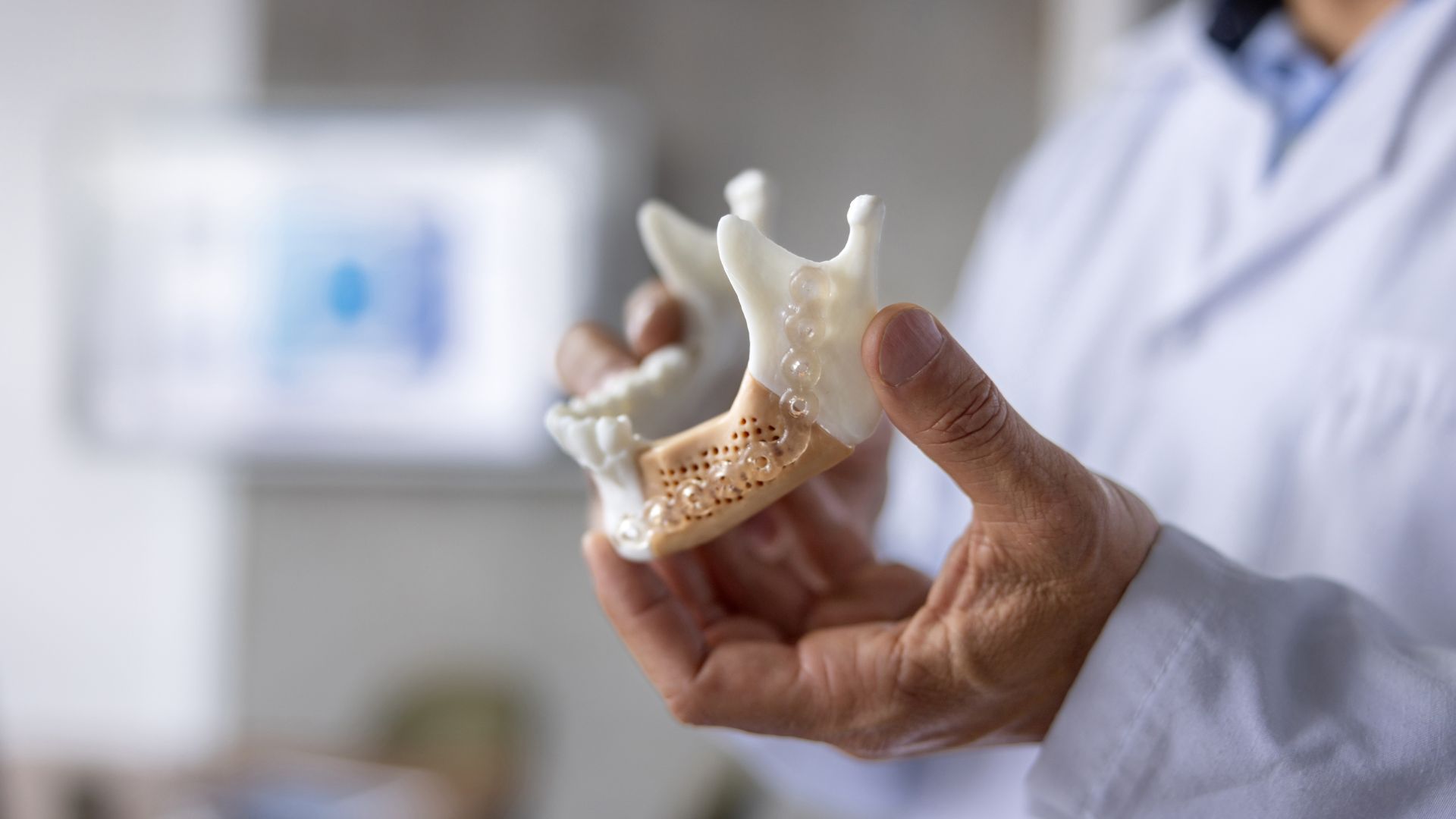 An oral surgeon holds a model of a mandible showing bone regeneration materials.